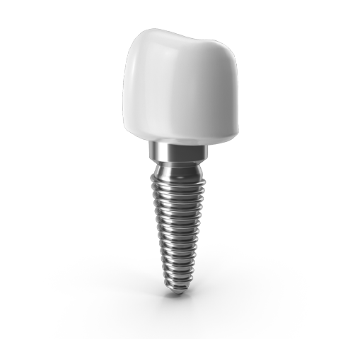 κοντινό πλάνο οδοντικού εμφυτεύματος